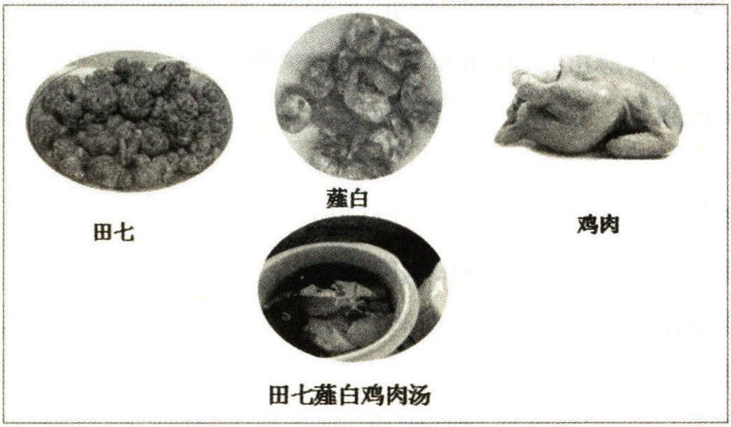 眩暈(高血壓)